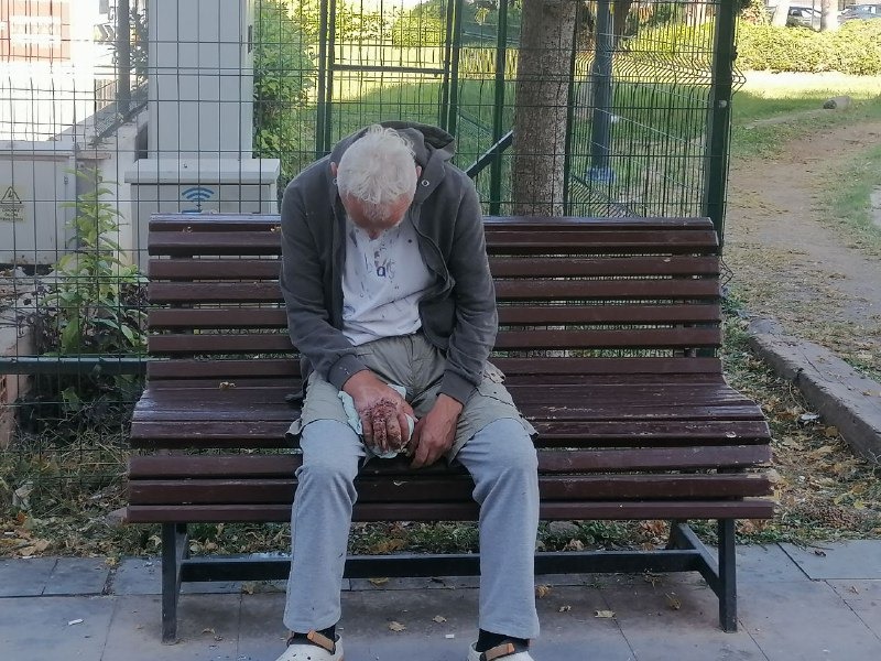 Açık Yara ile Sokakta Yaşayan Vatandaş Çevrede Endişe Yarattı