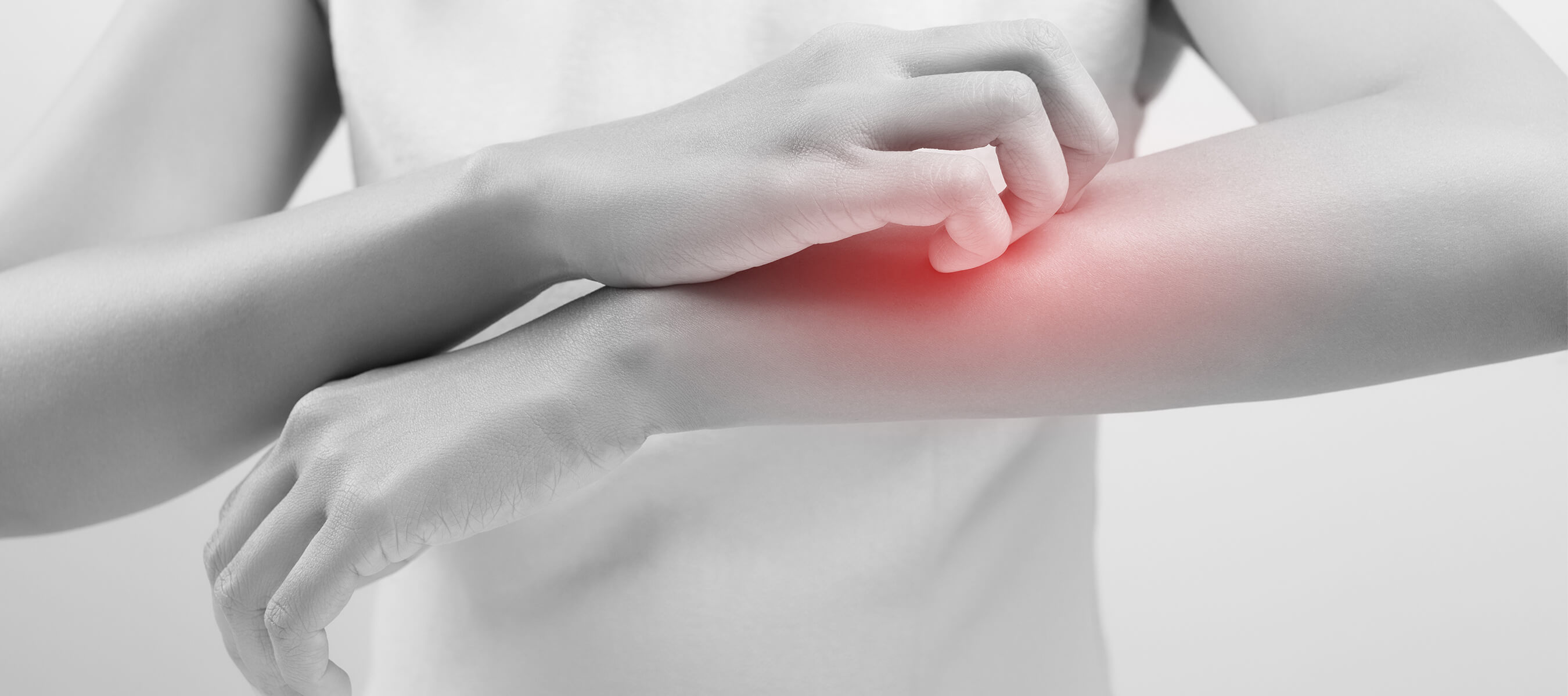 Atopik Dermatit İle Mücadelede Bilinmesi Gerekenler