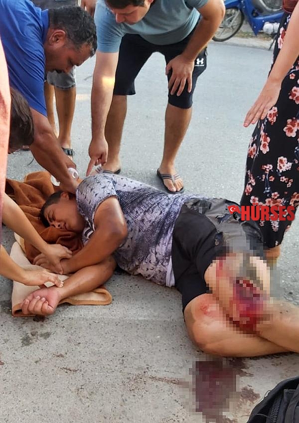 Kamyonetle çarpışan motosikletin sürücüsü yaralandı