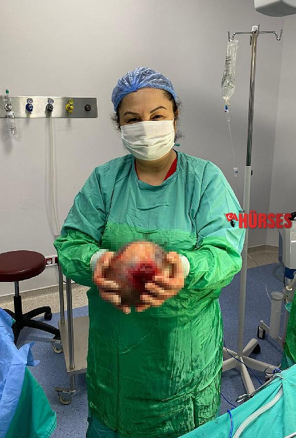 Rahminden 1,5 kiloluk kist çıktı