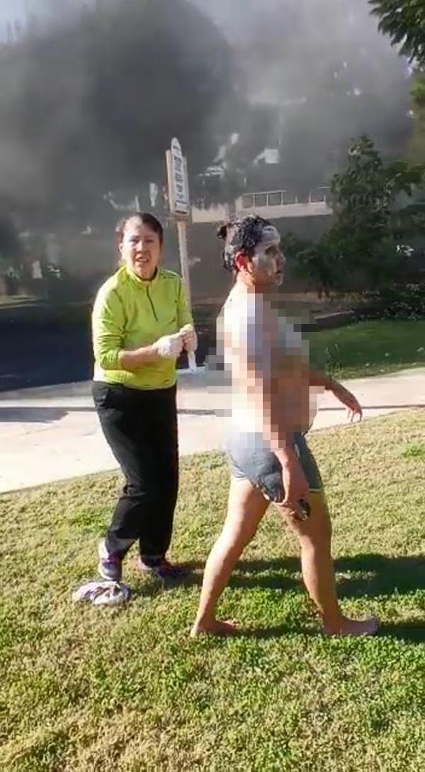 Karavanda çıkan yangında Gamze yaralandı