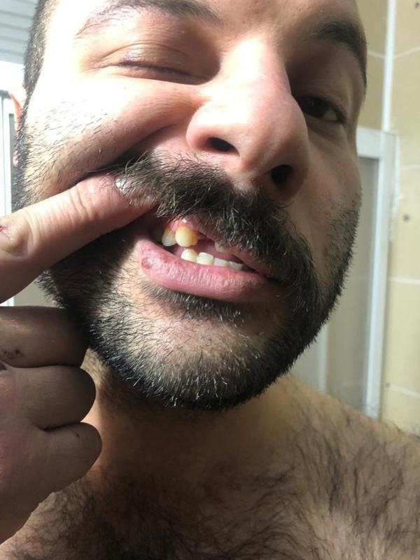 Polise, darptan 4 ay; şikayet edilene 'direnme' ve 'hakaret'ten 3 yıl hapis