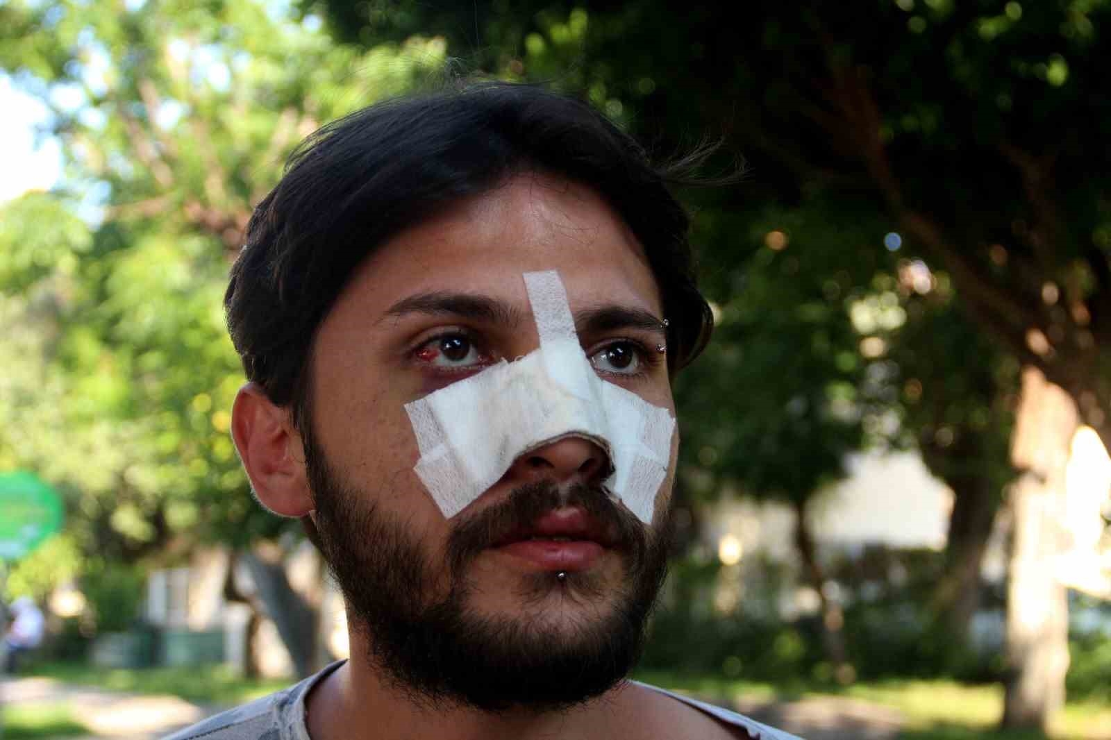 Antalya'da kiracı gence "ucuz kira" dayağı iddiası