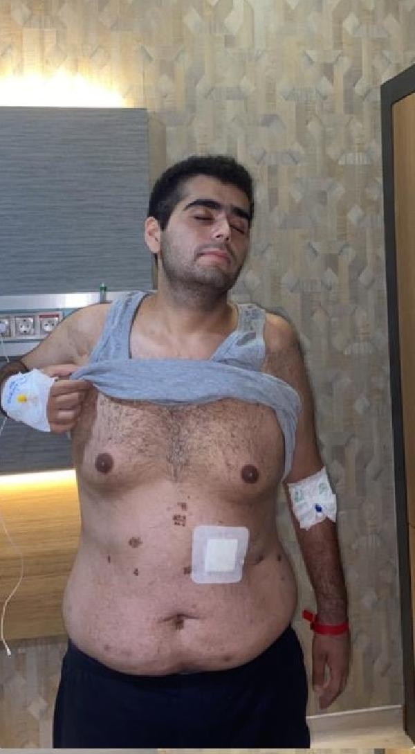 Askerlik hayaliyle mide küçültme ameliyatı oldu, ölümden döndü