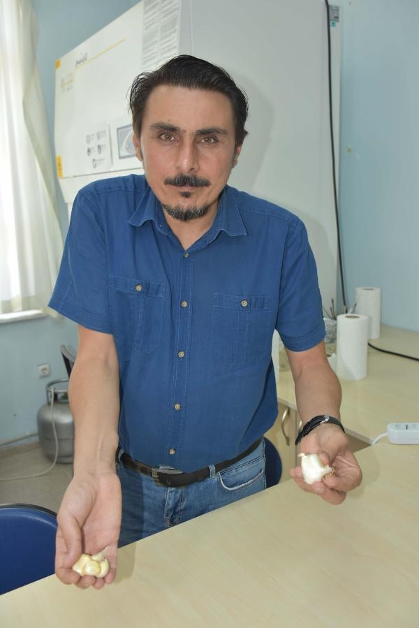 'Taşköprü sarımsağı antibiyotik özelliği bakımından Çin sarımsağından yüzde 100 daha etkili'