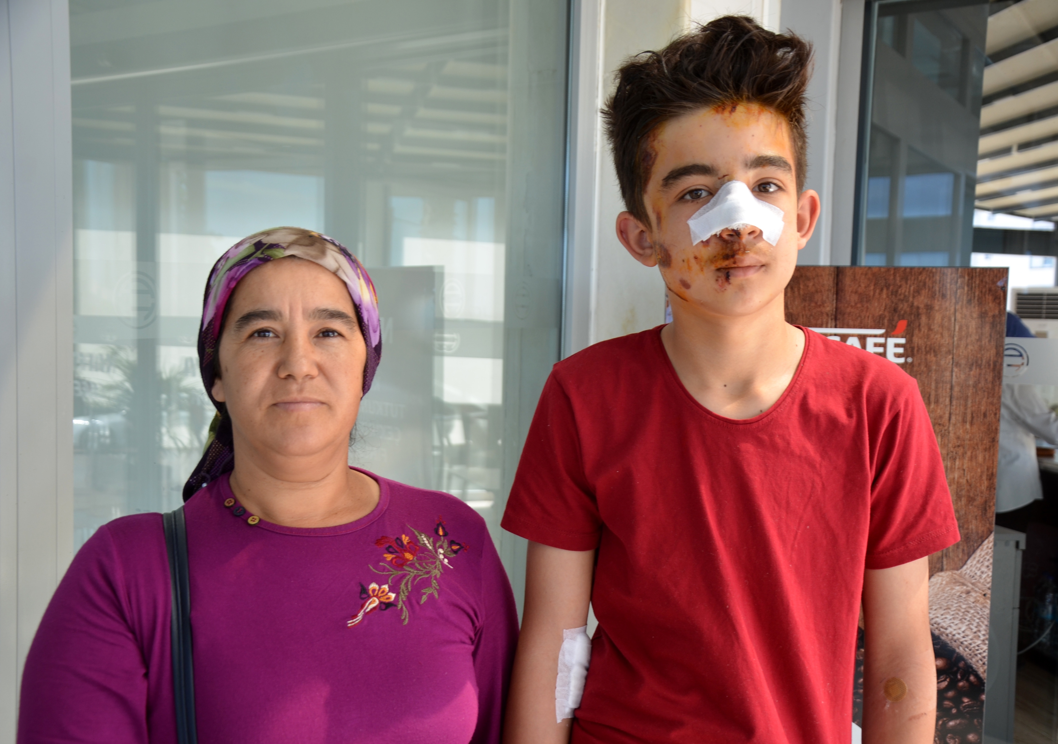 Köpeklerden kaçarken otomobilin çarptığı çocuk yaralandı !
