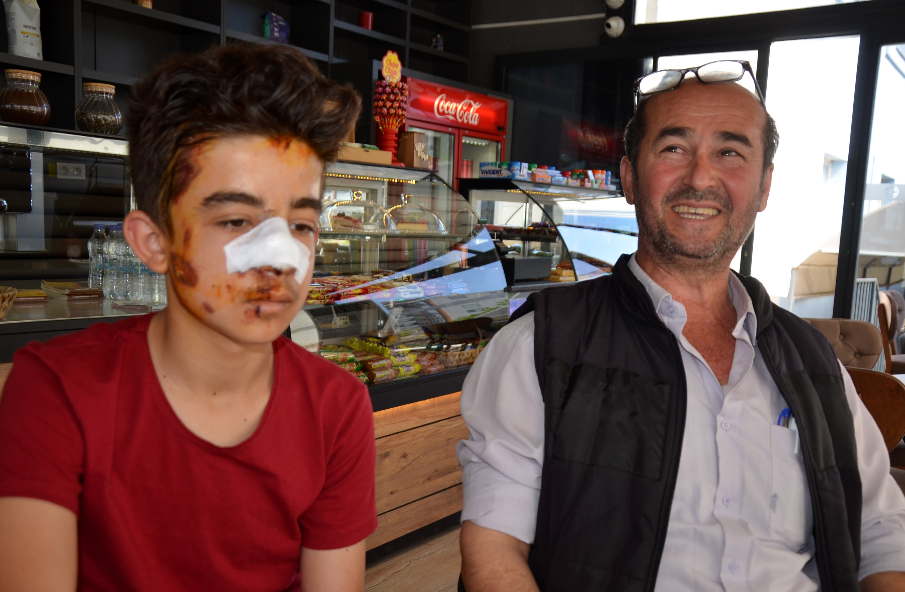 Köpeklerden kaçarken otomobilin çarptığı çocuk yaralandı !