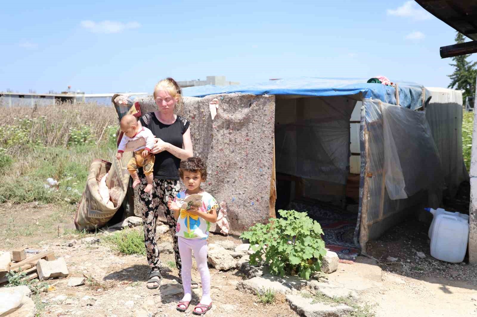 'Albino' kadının Adana sıcağında yaşam mücadelesi