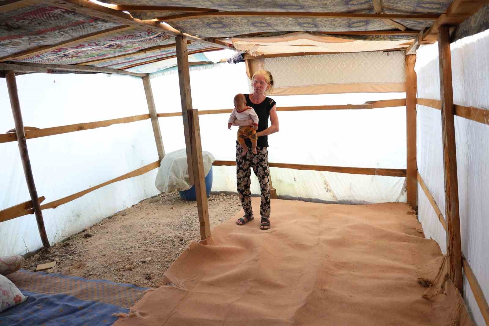 'Albino' kadının Adana sıcağında yaşam mücadelesi