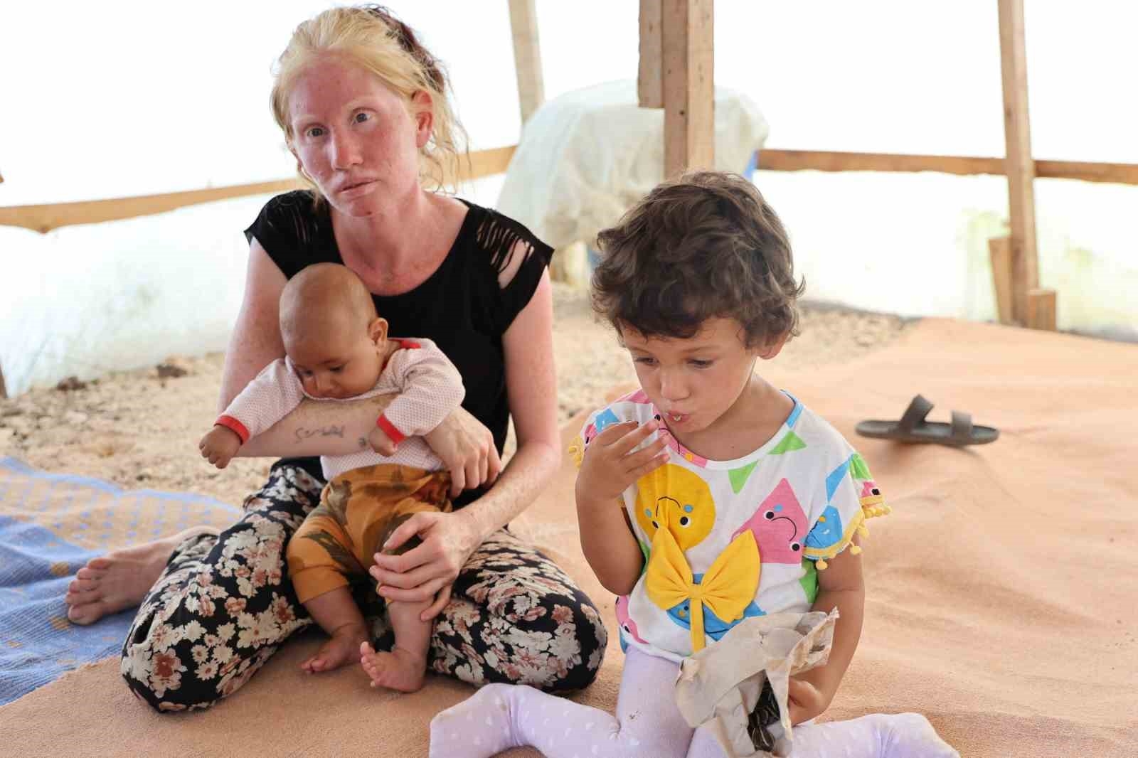 'Albino' kadının Adana sıcağında yaşam mücadelesi