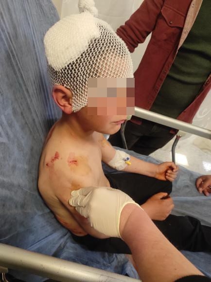 Isparta'da sokakta oynayan çocuğa başıboş köpek saldırdı