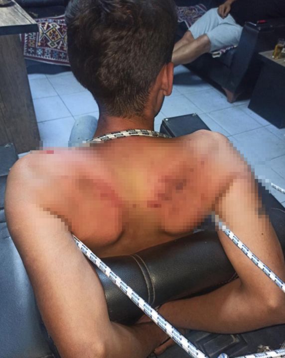 Böcek yedirip, dişlerini kırdılar; savcı 20'şer yıl hapis cezası istedi