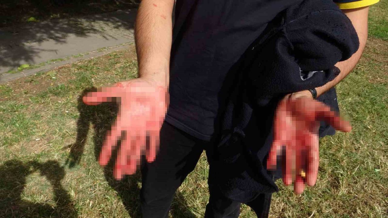 Eline aldığı bıçakla yoldan geçenlere dehşeti yaşattı: 1 yaralı