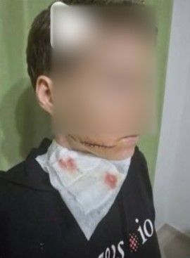 Alanya’da sokakta bir kadına yumruk atıp, makasla yüzünü yaralayan şahıs tutuklandı