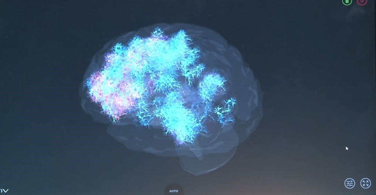 Nöroloji uzmanından uyarı: "Sanal ortamdaki öldürme eylemleri zamanla gerçek hayata yansıyabiliyor"