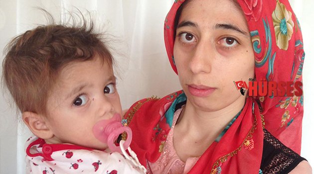 15 AYLIK BEBEK ORGAN BEKLİYOR