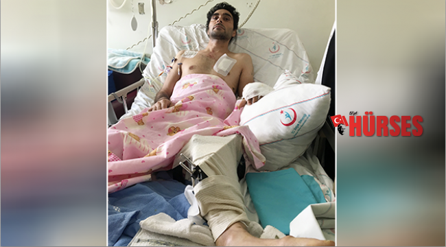 Vücuduna 80 cm’lik demir saplandı