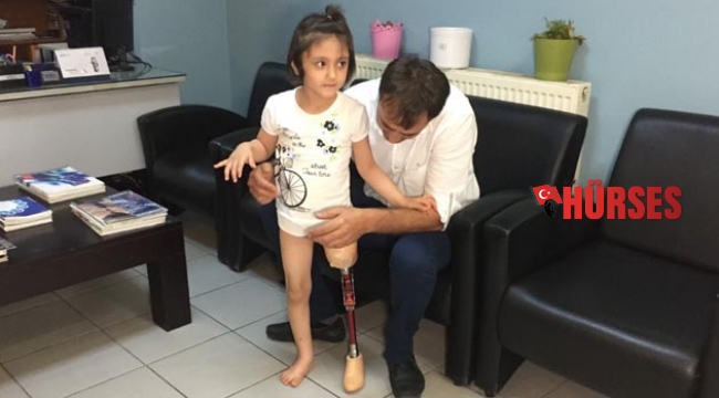 Özge’nin, protez bacak mutluluğu