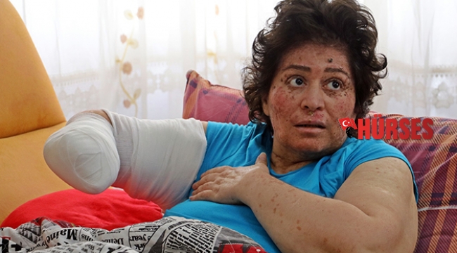 Korona değil güneş eve hapsetti