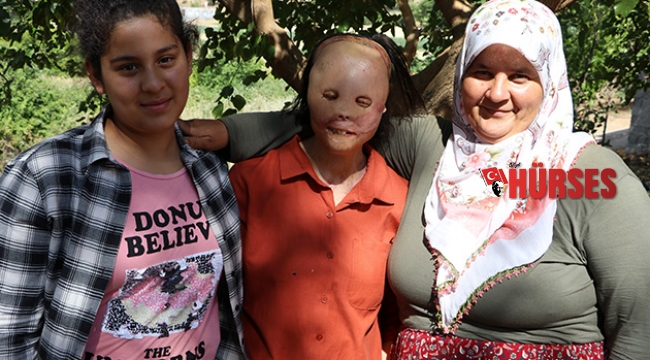 Akdeniz Üniversitesi Layla'nın yüzünü güldürdü