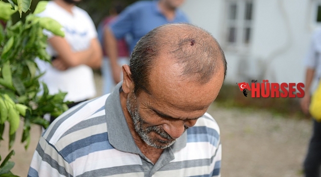 Doluya açık alanda yakalandı, başından yaralandı