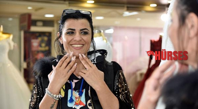Estetik uğruna yüzü yanan kadın, aynalarla barıştı