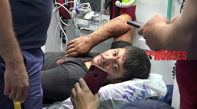 Tüfekle vuruldu, 1 kilometre yürüyüp arkadaşlarından yardım istedi