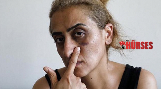 Ensemde ölüm kokusu alıyorum