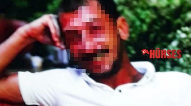 Bıçak tehdidiyle cinsel saldırı iddiasına gözaltı