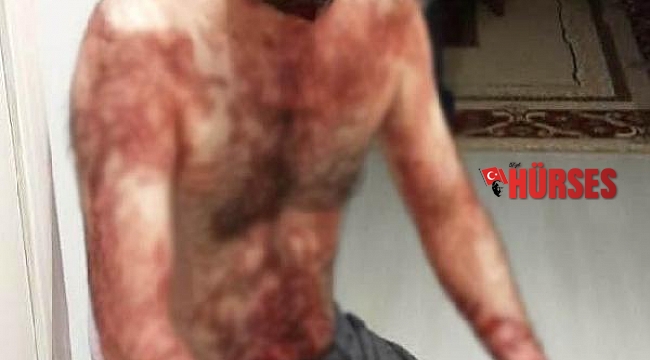 Antalya'da eski kocadan maket bıçaklı dehşet