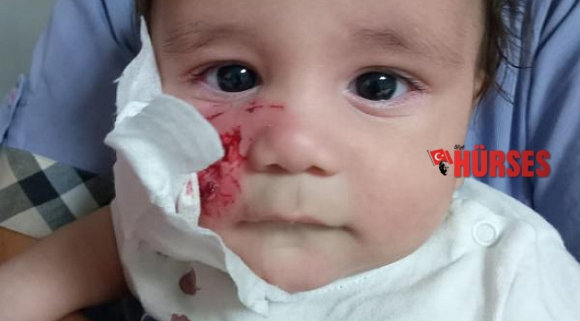 Şenlikte atın ısırdığı bebek yaralandı
