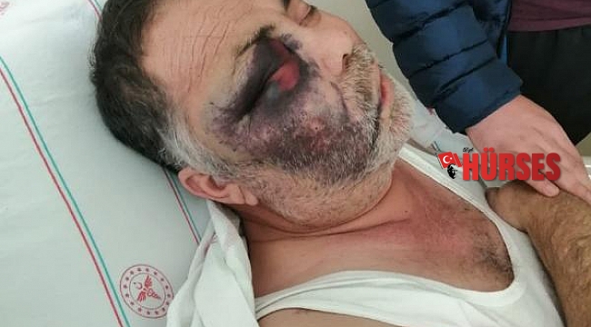 Engelliyi döverek öldürmekle suçlanan baba-oğlun beraatine itiraza ret