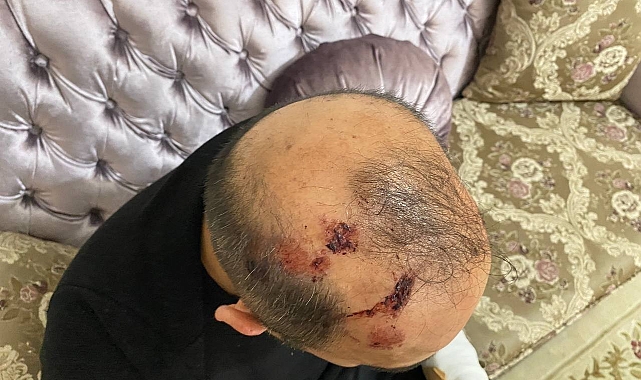 "Kaç defa vurdu sayamadım"