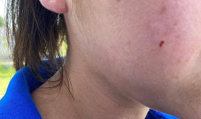 Yolda yürüyen genç kızlara dehşeti yaşattılar