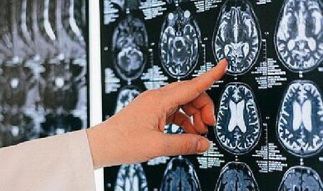 "Serebral palsili çocuklar için konforlu bir yaşam mümkün"