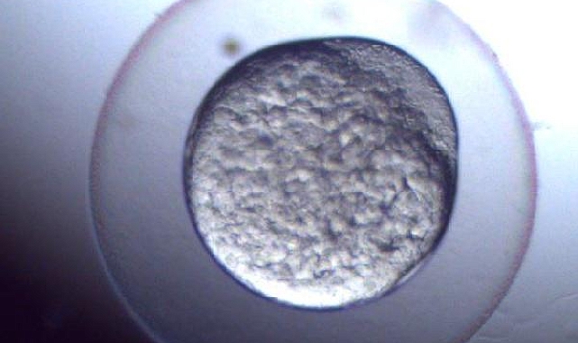 Atık ilaçların insan sağlığına etkisi araştırılıyor