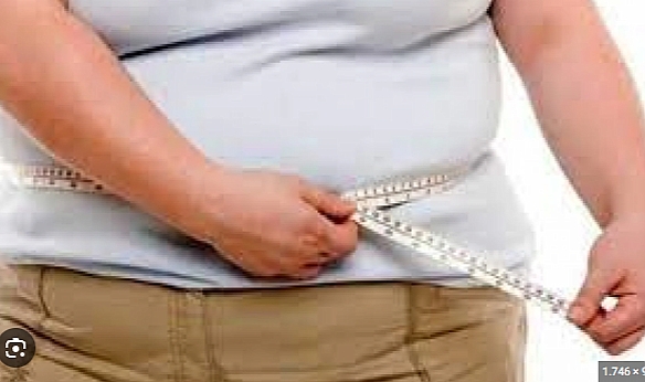 Obezite Cerrahisi Son Çare Olmalıdır