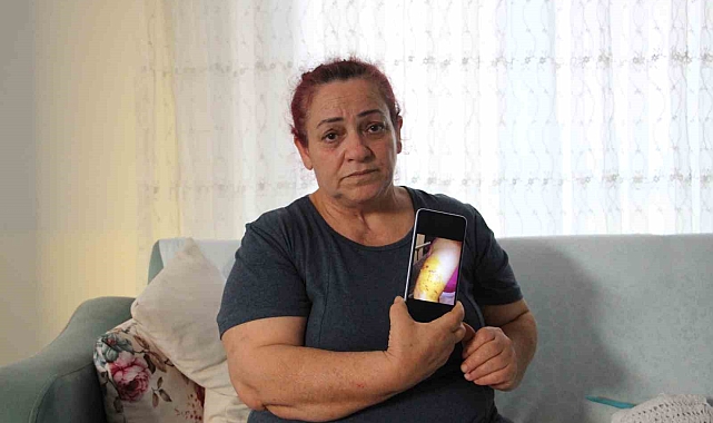 Köpek saldırısında yaşadığı dehşet anlarını unutamayan kadın tek başına sokağa çıkamıyor