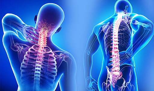 Fibromiyalji Sendromu: Gizemli Ağrıların Ardındaki Gerçek