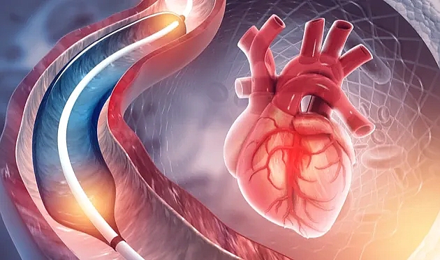 Modern Kalp Sağlığı Tarama Yöntemi: Sanal Anjiyo