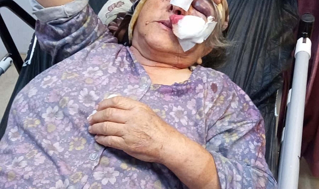 Kayınvalidesi ve kayınpederini darbeden damat tutuklandı