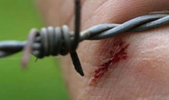Tetanos Nedir?  Nasıl Korunulur? İşte Önemli Bilgiler…