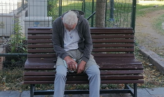 Açık Yara ile Sokakta Yaşayan Vatandaş Çevrede Endişe Yarattı