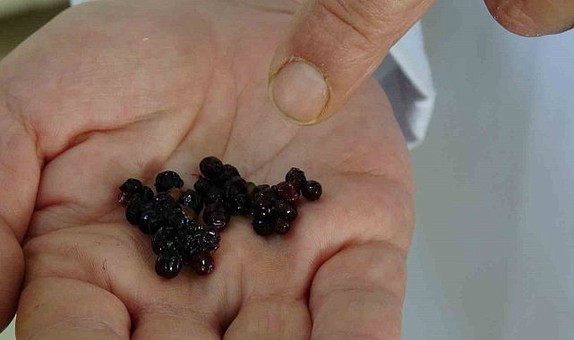 Dünyada en çok görülen kanserlerden kolon kanserine yeni bir çare
