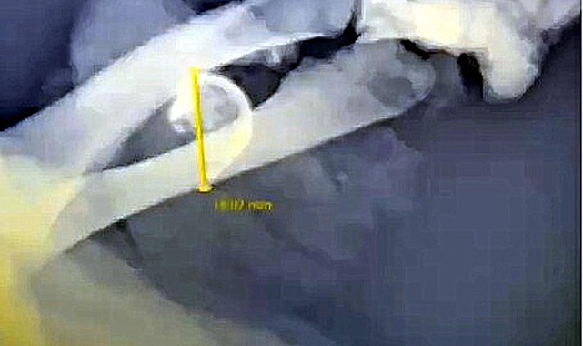 Dalyan Kanalı'nda yaralı caretta caretta bulundu