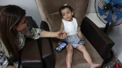 Küçük Ayşe yaşam savaşını kazandı, özel tedaviyle hayata tutundu