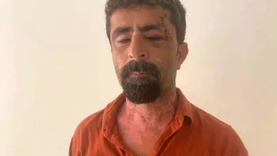 Antalya’da öfkeli damat kayınpederini hastanelik etti