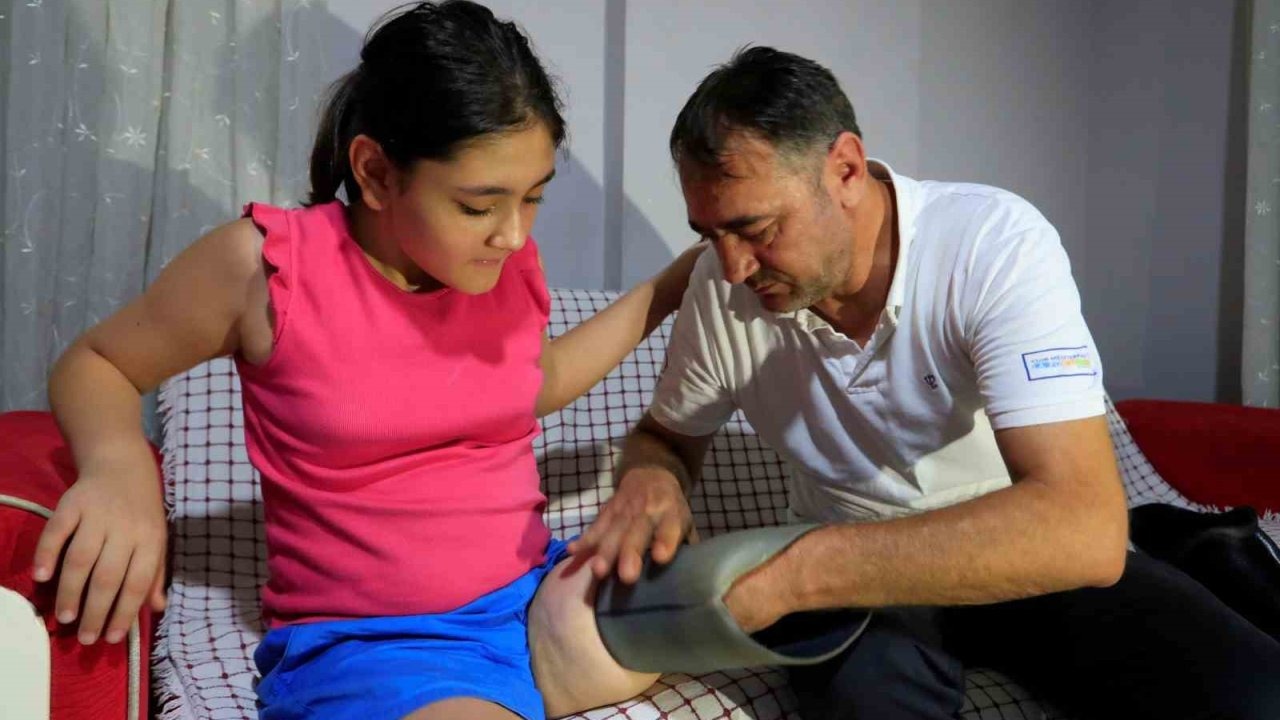 Protez bacağı dar gelen Özge için Türkiye ayağa kalktı