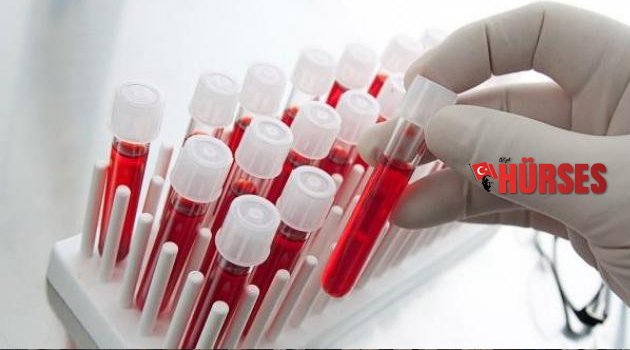 50 YAŞINDAN SONRA PSA TESTİ YAPTIRIN