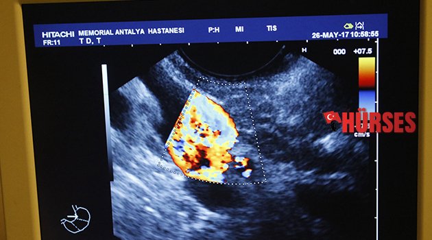 DETAYLI GÖRÜNTÜLEME